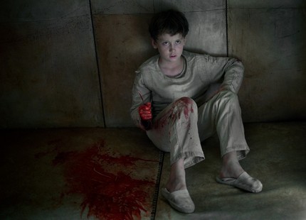 Impressive First Images From Juan Carlos Medina's PAINLESS (INSENSIBLES)