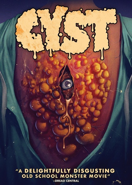 CYST DVD Giveaway